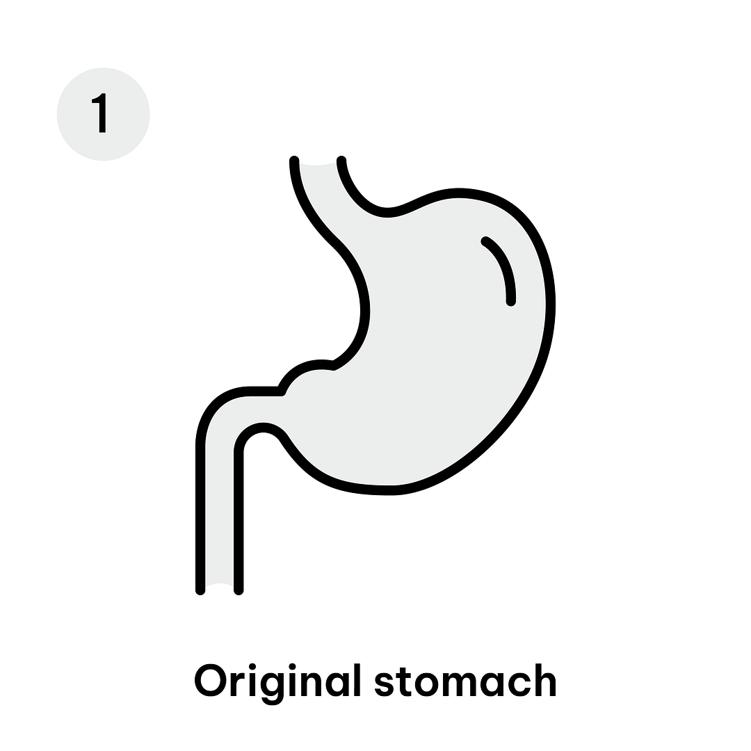 Gastric Diagrams_Mini GB 1