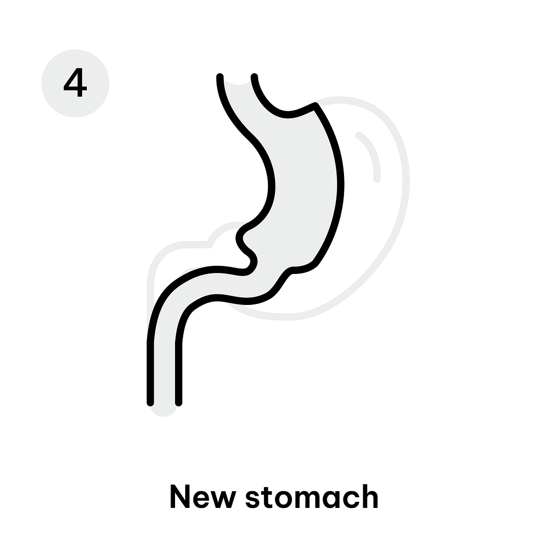 Gastric Diagrams_Mini GB 4