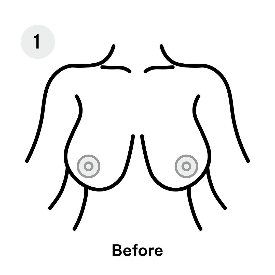 Reduction Diagrams-46