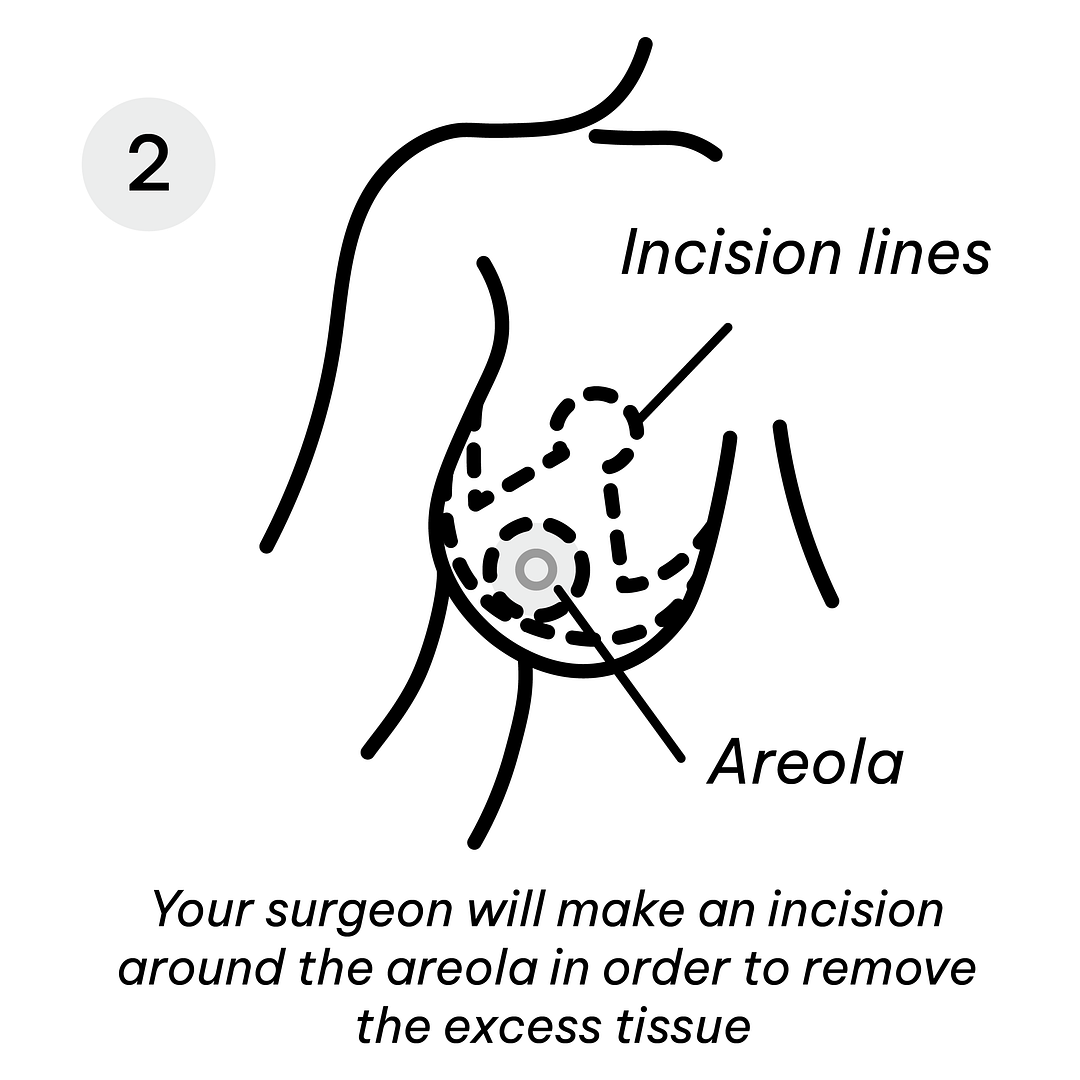 Reduction Diagrams-47